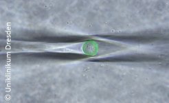 cellpick_overlay_ukd_q.jpg