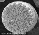 Rasterelektronenmikroskopische Aufnahme der Biosilica-Struktur der Kieselalge Cyclotella cryptica