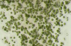 Mikroskopische Aufnahme einer Mikroalge. Felix Krujatz hat in seiner Doktorarbeit an der Fakultät Maschinenwesen ein Verfahren entwickelt, mit dem Algen gemeinsam mit anderen organischen Zelltypen 3D-gedruckt werden können. Abbildung: Anja Lode/TUD